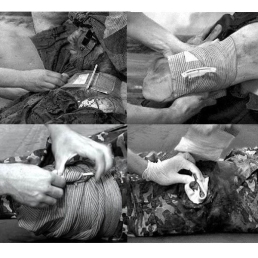 Pansement compressif type israëlien