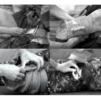 Pansement compressif type israëlien