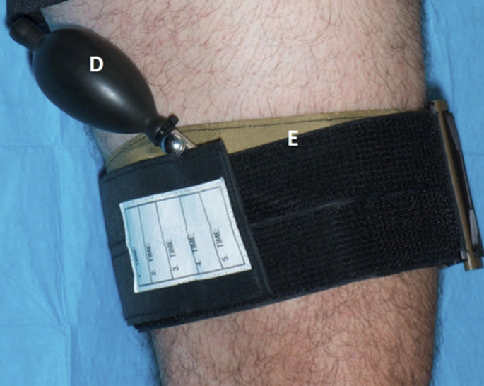 Garrot Compression Histoire et Évolution du Garrot - Un Sauveur Silencieux Dévoilé